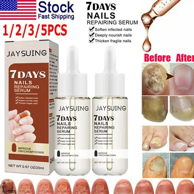 7 Days Nail Repair Serum Fungus Toe Nail Fungus Treatment Onychomycosis Remover • $8.82