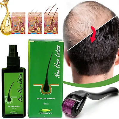 $18.93 • Buy NEO Hair Regrowth Lotion Haircare / Hair Loss Oil / Baldness/ & 1 Derma Roller