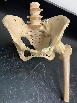Vintage Anatomy Model Of Pelvis Hip And Lumbar Spine With Nerves • $89.99