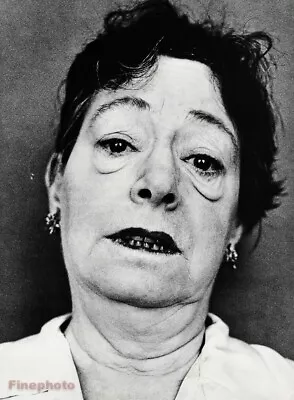 $178.14 • Buy 1958 Dorothy Parker Poet By RICHARD AVEDON Lady Writer Satirist Photo Art 16x20