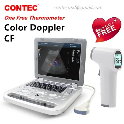 £3337 • Buy Color Doppler Ultrasound Scanner Portable Laptop Machine Color Diagnostic Convex