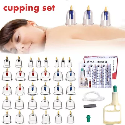 Cupping Vacuum Massage Suction Cups Set Therapy Health Acupuncture Kit • £15.99