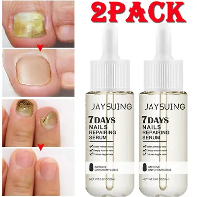 Anti Fungal Treatment Nail Rerair Serum Toenail Fungus Fungi Nail Athlete's Foot • $11.28