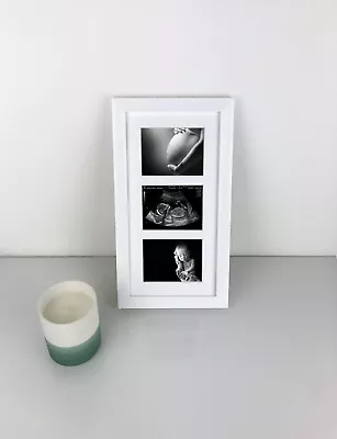 Triple Baby Scan & 1st Photo Ultrasound Sonogram Scan Print Photo Frame • £15.95