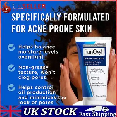 Acne Foaming Wash Face & Body 10% Active Ingredient 156g New Moisture UK • £8.88
