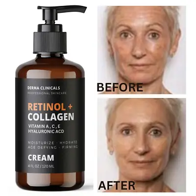 Retinol + Collagen Hyaluronic Acid Vitamin C AntiAging Wrinkle Serum Cream 4oz • $17.99