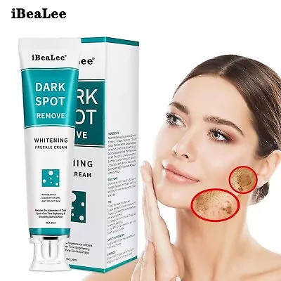 IBeaLee Whitening Freckle Cream Remove Melasma Dark Spots Cream Anti-Aging 20ml • £6.99