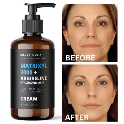 Matrixyl 3000 Argireline Hyaluronic Acid Peptide AntiAging Serum Wrinkle CREAM • $17.99
