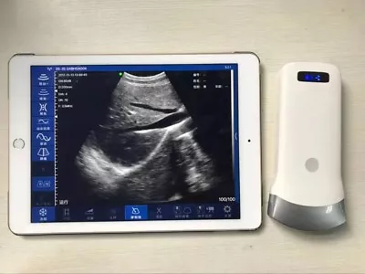 Digital Portable Ultrasound Equipment Linear Probe Ios Andriod US Local Shipping • $902.50