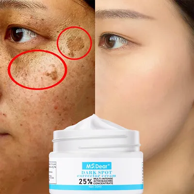 £7.44 • Buy Hyaluronic Acid Face Cream Anti-aging Dark Spots Removal Freckle Wrinkle Cream