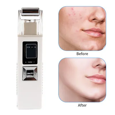 Galvanic Facial Microcurrent Skin Lift Firming Machine Anti-aging Massager • £35.99