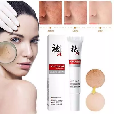 Whitening Freckle Removing Cream Melasma Anti Aging Serum Wrinkles Remove√ • £3.62