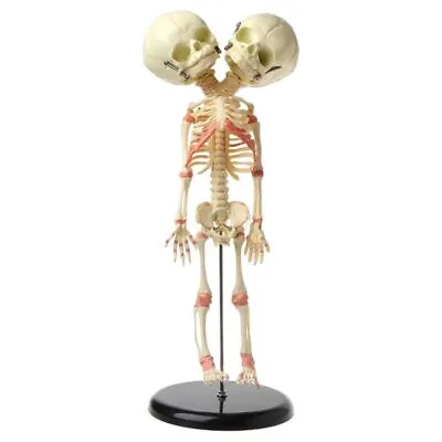 37cm Human Double For Head Baby Skull Skeleton Anatomy Brain Display Study Teach • £35.16