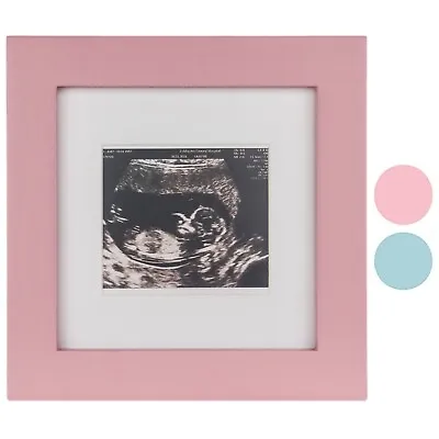 Ultrasound Scan Photo Picture Frame Pregnancy Baby Shower Present Gift Keepsake • £5.95