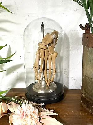 Antique Vintage Genuine  Human Feet Foot Skeleton Bones Mounted In A Glass Dome • $487.09