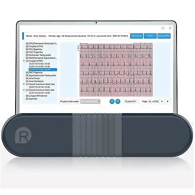 Portable ECG Bluetooth Heart Device Detect AFib Reliable 24hrs Holter Recorder • £467.99