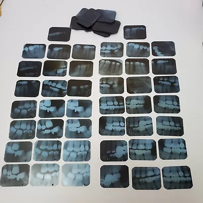 60 Vintage Dental X-Rays Dentist Teeth Tooth Xray Lot Fillings Cavaties Slides • $9.99