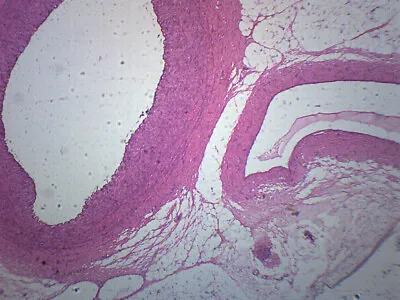 Human Artery Vein & Nerve - CS - Prepared Slide - 75x25mm - Eisco Labs • $8.99