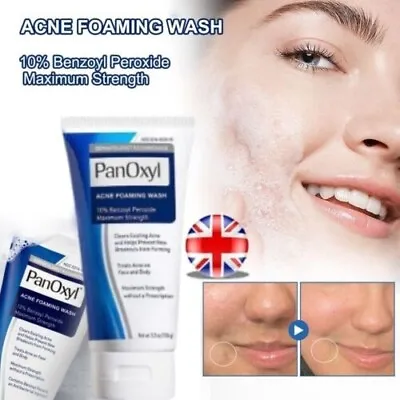 Acne Foaming Wash Face & Body 10% Active Ingredient 156g New UK 2024 • £8.39