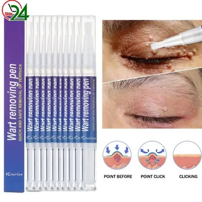 10PCS 12Hours Wart Remover Pen Skin Tag Mole Remover Eliminate Foot Corn Warts • $8.82