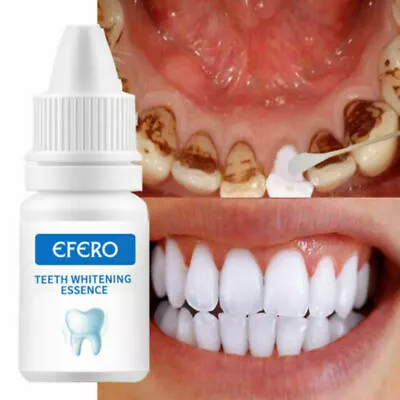 New Instant Tooth Whitening Kit White Teeth Clean Gel Uv Bleach Dental Strength • $12.45