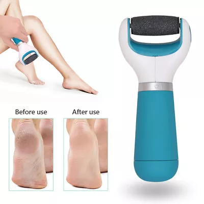 Electric Foot Pedicure Roller File Feet Hard Rigid Skin Callus Remover Pedi Tool • £4.19