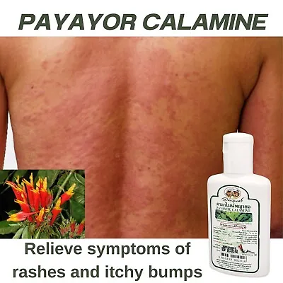 PAYAYOR Calamine Thai Herb Relieve Symptoms Treat Hives Rashes Itching 60ml • $23