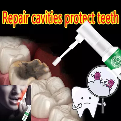 £3.79 • Buy 20ml Tooth Pain Relief Treatment Spray Periodontitis Cleaner Toothache Cure New