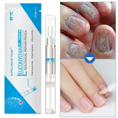 Euconychia Herbal Nail Fungus Treatment Pen Anti Fungal Nail 2024 • $1.46