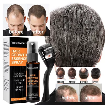 Derma Roller Beard Hair Growth Essential Oil Kit For Men Hair Growth Spray Kit☆ • $11.92