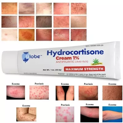 Cremas Para Dermatitis Eczema Psoriasis Para Comezon Picazon Ronchas En La Piel • $24.95