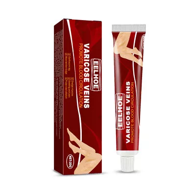 Varicose Veins Vasculitis Treat Foot Anti Swelling Spider Skin Leg Massage Cream • £6.79