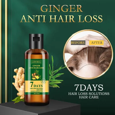 7 Day Ginger Germinal Hair Growth Serum Hairdressing Oil Loss Nutrition Liquid • $7.17