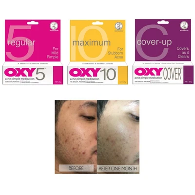 £74.81 • Buy 25g OXY10 For Stubborn Acne Pimple Medication And Spot Control Treatment