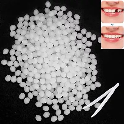 3.5 Oz / 100 G Temporary Tooth Repair Kit - Moldable Thermal Fitting Beads • $14.42