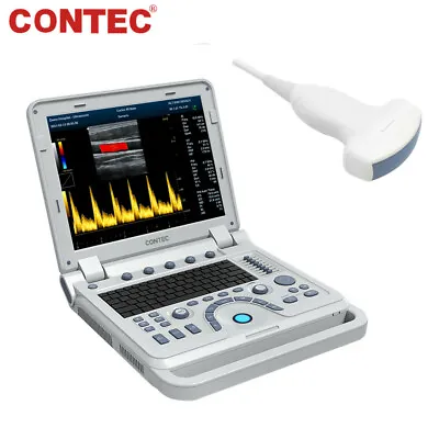 £3337 • Buy Portable Color Doppler Ultrasound Scanner Laptop Machine W Convex Probe CMS1700A
