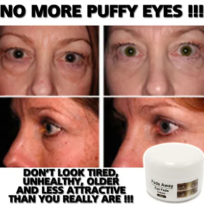 Fade Away Eye Fade Cream Lotion Stop Puffy Eyes Dark Circles Natural Herbal • £14.95