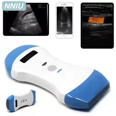 Wireless Ultrasound Probe SCANNER Portable USG WIFI IOS Android Windows APP FDA • $943.04