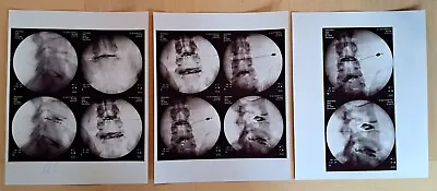 Used X-RAY Film Photograph Discogram Discography Lumbar Spine Anatomy ~ Lot Of 3 • $17.98