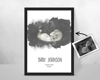 Personalised BABY Scan Ultrasound Watercolour Print/ New Mum/ Mother Gift Idea • £12.35