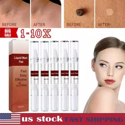 5PCS Wipe Off Skin Tags & Moles Removal Quick Safe Remover Restore Skin Hot • $8.99