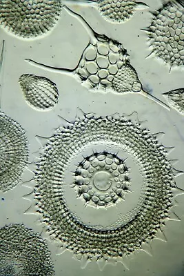 Antique Microscope Slide By Eduard Thum. Exhibition Circle Of Radiolaria. 100 Fs • $27.35