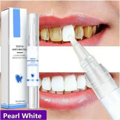 $5.16 • Buy Teeth Whitening Gel Pen Extra Strong White Hygiene Tooth Whitener Stain Removal