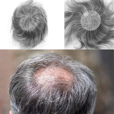 Grey Thin Skin Bald Spot Hair Patches Toupee For Men Human Hair 8x8cm Hairpiece • $31.92