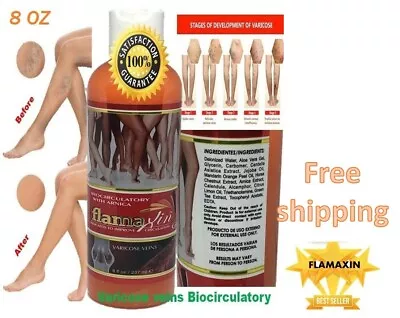 Leg Vein Support Herbal Ointment Varicose Veins Vasculitis Support Foot Care Cre • $12.50