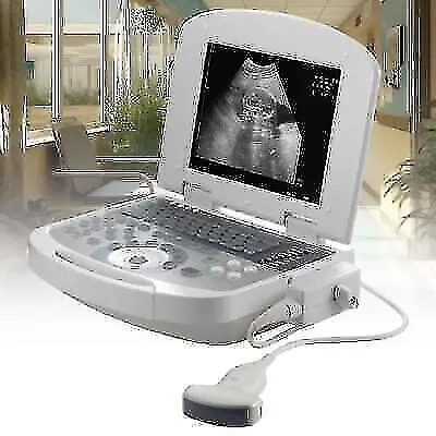 Portable Ultrasound Scanner Machine + Convex Probe Set - Medical Equipment • $1799