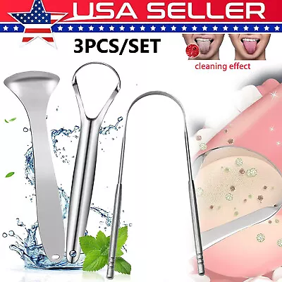 3 PCS Tongue Scraper Cleaner For Adult Stainless Steel Rust Metal Dental Scraper • $6.68