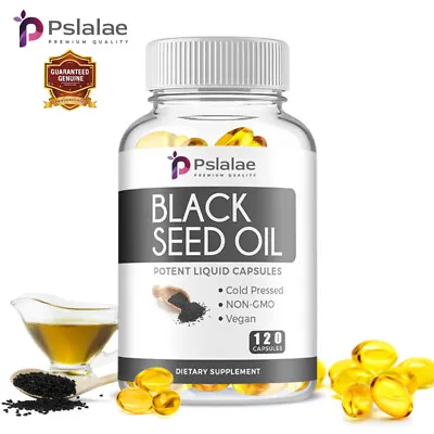 Black Seed Oil Capsules 1000mg - HairSkinDigestion & Immune Support Supplement • £13.14