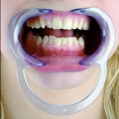 1 Pcs Mouth C Shape Opener Dental Cheek Retractor Fun Game Watch Large Size Blue • £5