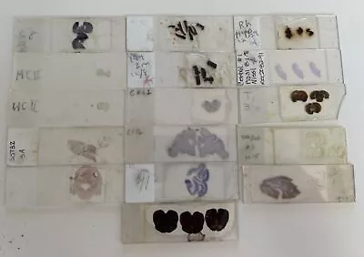 16 Vintage Random Neuroanatomy Microscope  Slides Specimens • $54.62